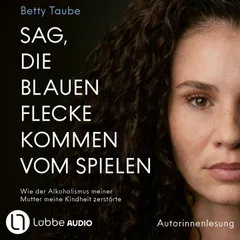 Sag, die blauen Flecke kommen vom Spielen